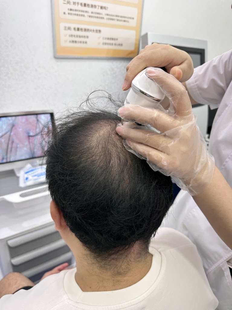 毛髮檢測