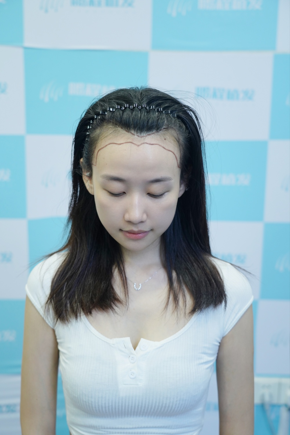 术前设计
