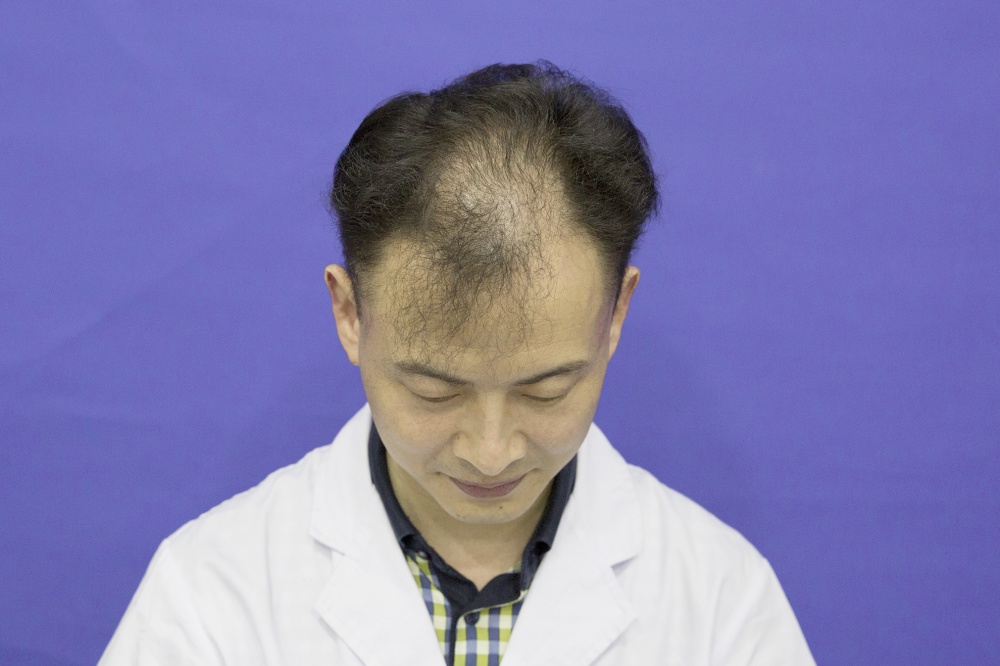術前狀況