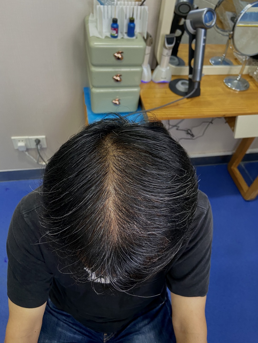 術後7個月 術後7個月