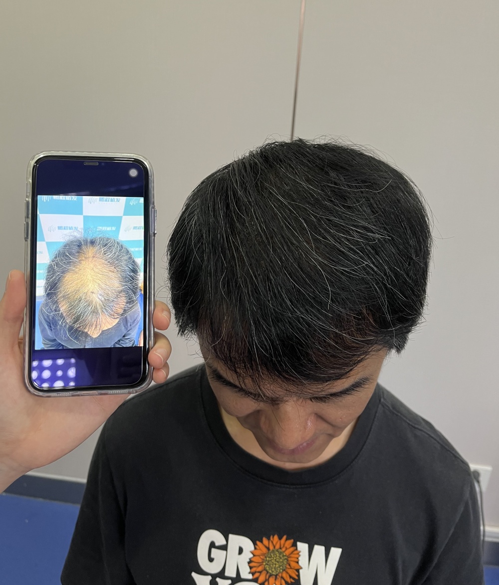 術後10個月