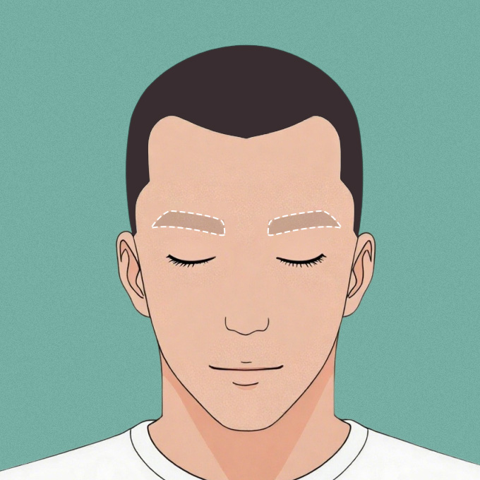 植眉手術